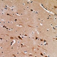 Polyclonal Rabbit anti-Human EIF3M / PCID1 Antibody (IHC, WB)