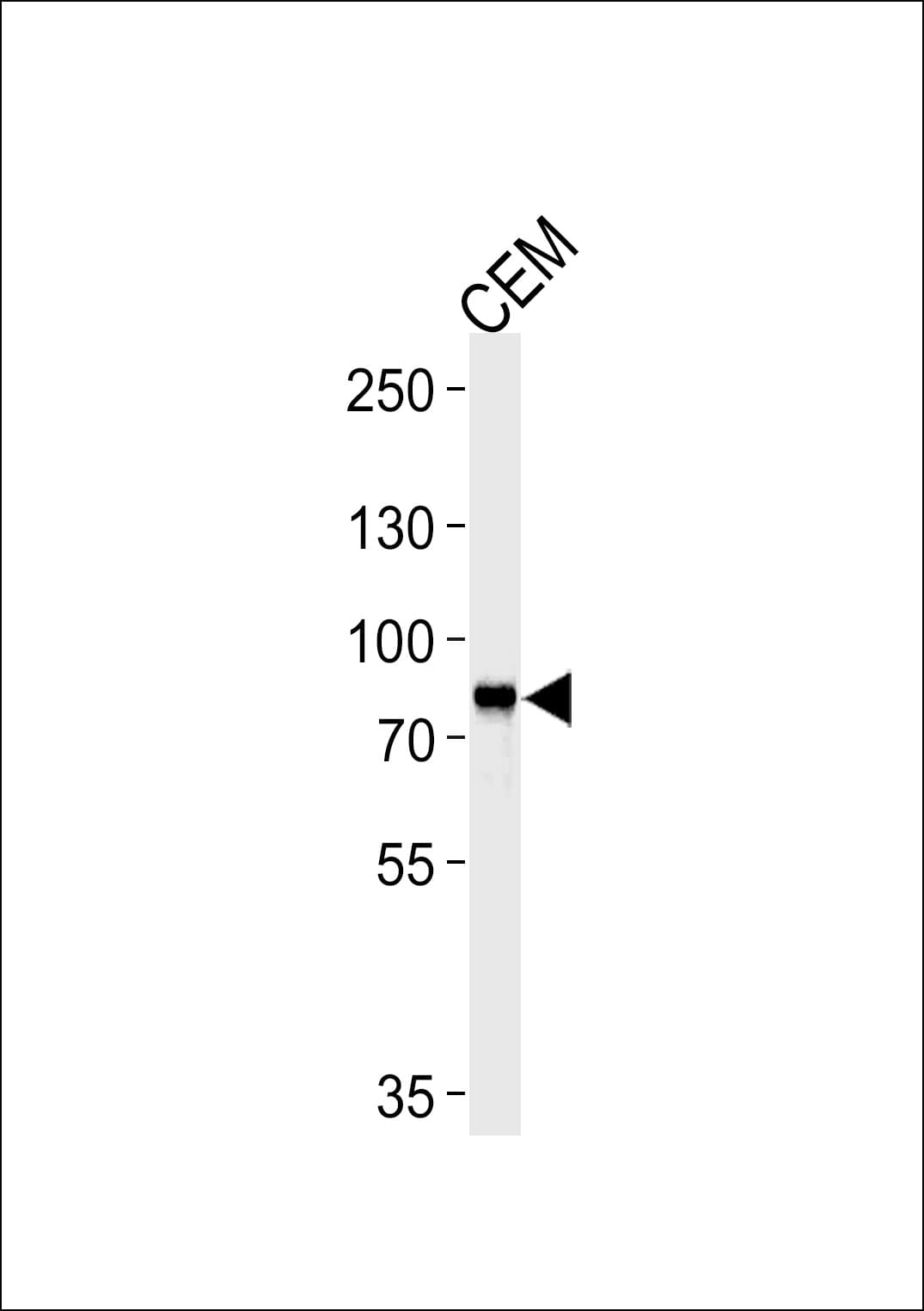 MYB / c-Myb Antibody (aa1-185, clone 1279CT309.289)
