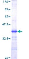 Human AKT1 Protein (Recombinant GST, N-terminus)