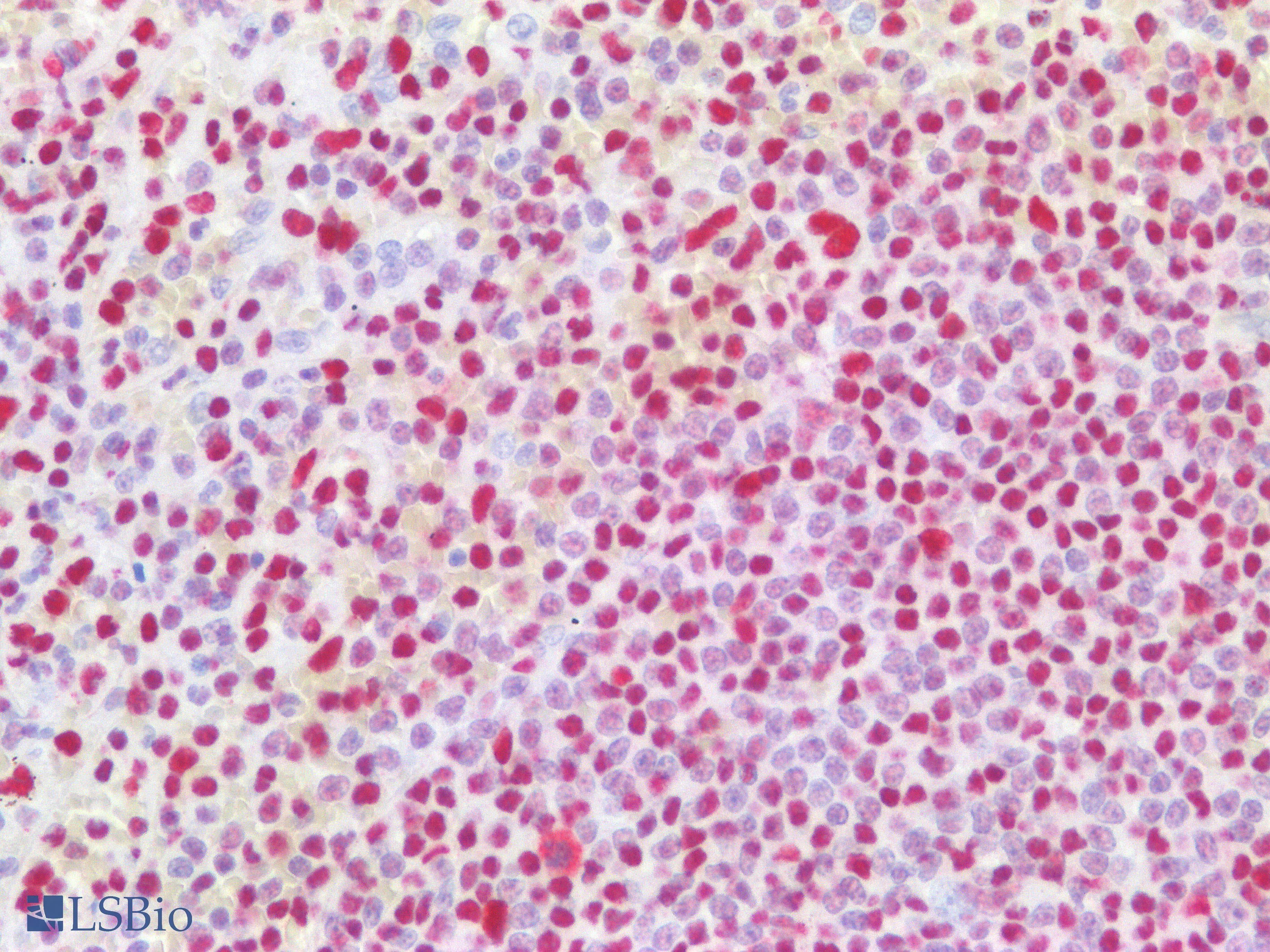 PathPlus™ NF45 / ILF2 Antibody (clone OTI6F1)