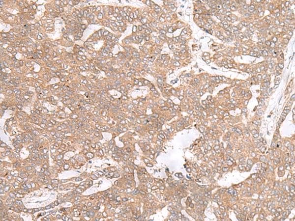 Polyclonal Rabbit anti-Human PTP4A3 Antibody (IHC)