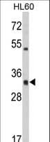 Polyclonal Rabbit anti-Human HLA-DRA Antibody (aa149-177, IHC, WB)