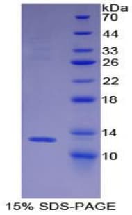 Mouse BRAK / CXCL14 Protein (Recombinant His-T7)