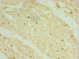 Polyclonal Rabbit anti-Human NKX2-5 Antibody (aa1-135, IHC)