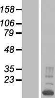 RBM38 Protein (Over-Expression Lysate Myc-DDK (Flag))