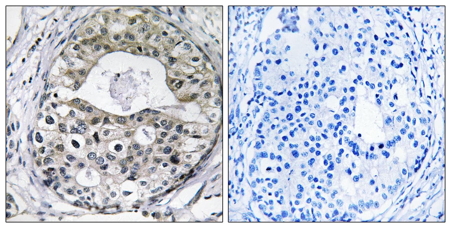 RPS13 / Ribosomal Protein S13 Antibody