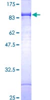 Human IGF2BP2 Protein (Recombinant GST)