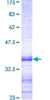 Human HDAC5 Protein (Recombinant GST, N-terminus)