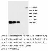 IL8 / Interleukin 8 Antibody (aa77-95)