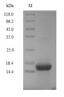 Human Complement C5 Protein (Recombinant 6His, N-terminus)