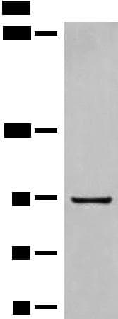 DMGDH Antibody