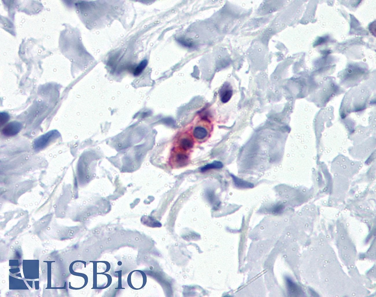 IHC-plus™ Monoclonal Mouse anti-Human FcERI / Fc Epsilon RI Antibody (clone AER-37 (CRA1), IHC)