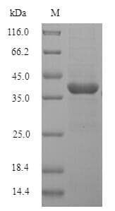 Rat Lumican Protein (Recombinant 6His, N-terminus)