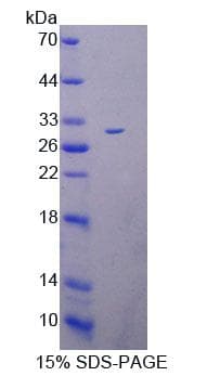 Human SELN / SEPN1 Protein (Recombinant His-T7, N-terminus)
