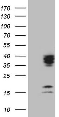 C21orf62 Antibody (clone OTI6C2)