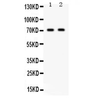 Polyclonal Rabbit anti-Human FZD1 / Frizzled 1 Antibody (aa369-400, IHC, WB)