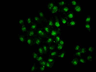 Polyclonal Rabbit anti-Human HIST1H3A Antibody (IHC, IF, WB)