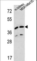L2HGDH Antibody (aa132-159)