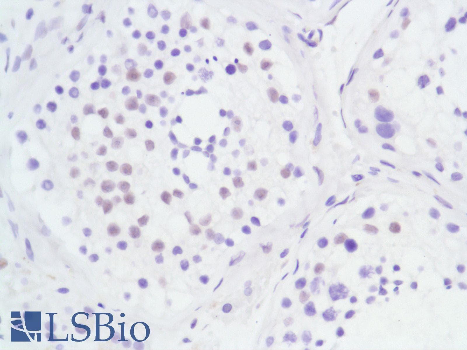 Monoclonal Rabbit anti-Human AR / Androgen Receptor Antibody (clone SP107, N-Terminus, IHC)