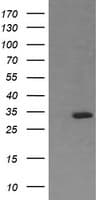 RARRES1 Antibody (clone OTI1B8)