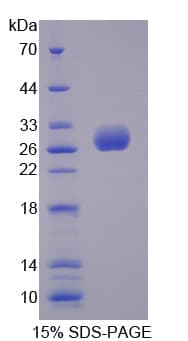 Human ULBP2 / RAET1H Protein (Recombinant His-T7)