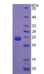 Human CALR / Calreticulin Protein (Recombinant His)