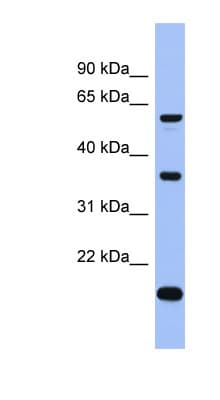 LARP6 / ACHN Antibody (C-Terminus)