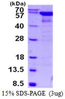 Human CAT / Catalase Protein (Recombinant His)