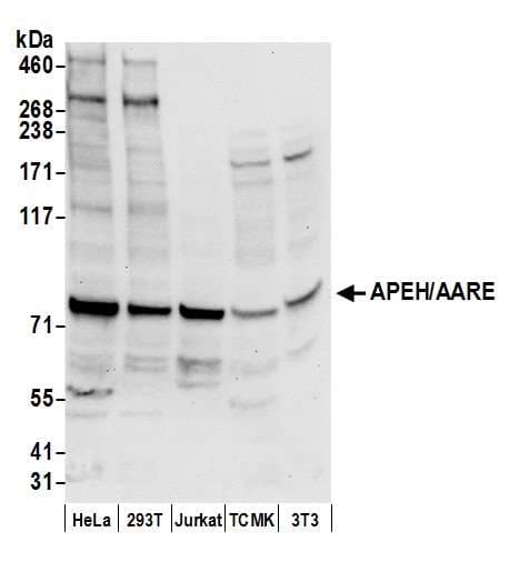 Polyclonal Rabbit anti-Human APH / APEH Antibody (aa150-200, WB)