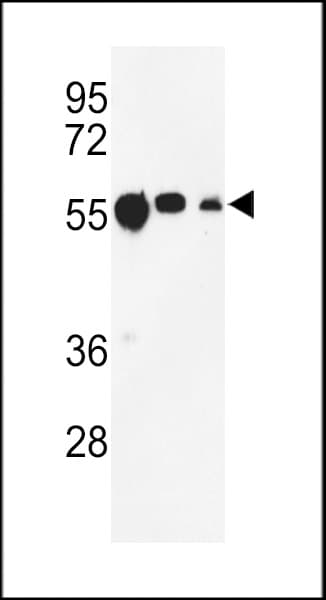 TUBB1 / Tubulin Beta 1 Antibody