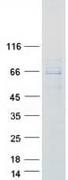 Human FRS2 Protein (Recombinant Myc-DDK (Flag))