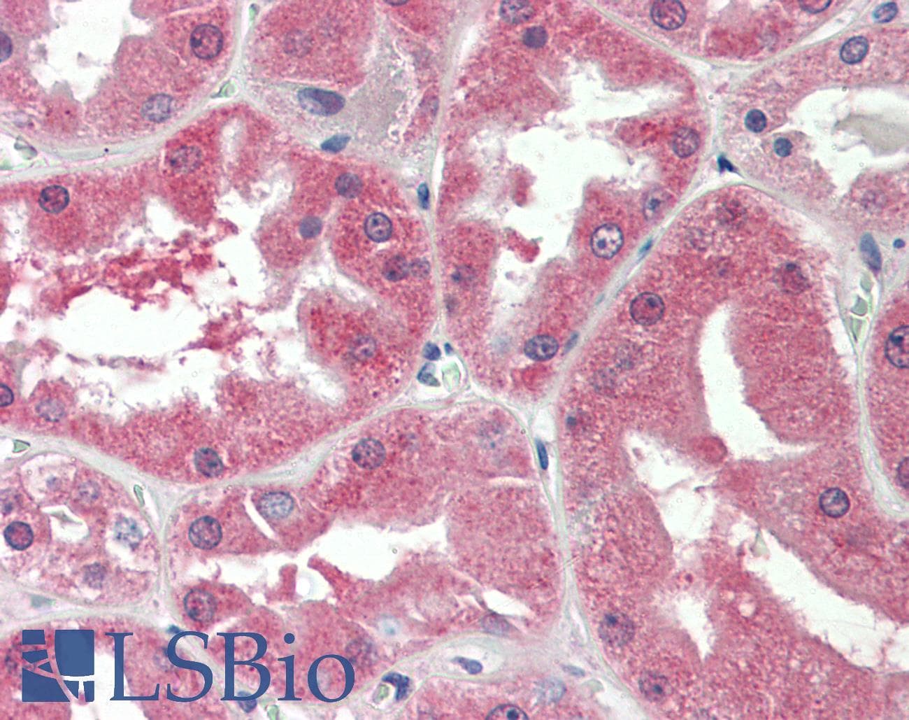 IHC-plus™ SLC47A2 Antibody (aa546-560)