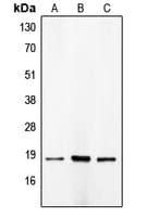 CDKN2C / p18 INK4c Antibody (C-Terminus)