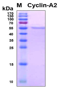 Human CCNA2 / Cyclin A2 Protein (Recombinant 6His, N-terminus)
