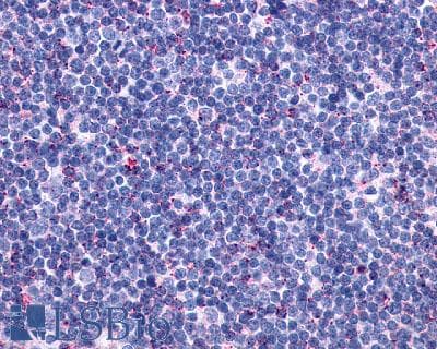 PathPlus™ CCR10 / GPR2 Antibody (Extracellular Domain)