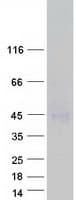 Human TSH Receptor / TSHR Protein (Recombinant Myc-DDK (Flag))