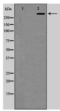 Polyclonal Rabbit anti-Human KAT2B / PCAF Antibody (IHC, WB)