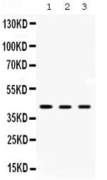 AMACR / P504S Antibody