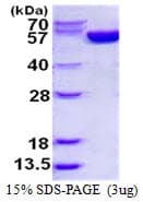 Human G6PD Protein (Recombinant His)