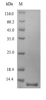 Mouse Ly6g / Gr1 Protein (Recombinant 10His, N-terminus)