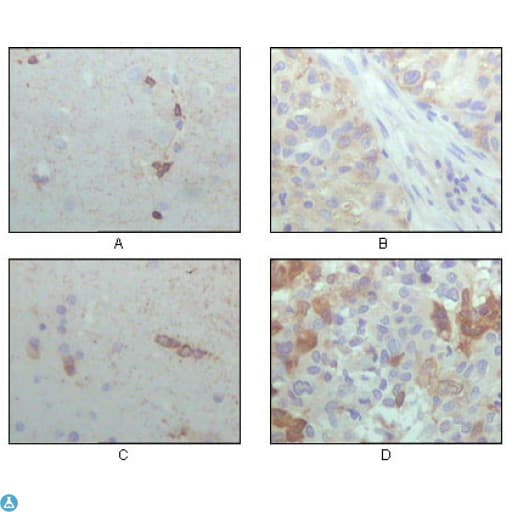 CRYAB / Alpha B Crystallin Antibody
