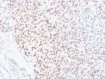 MITF Antibody (N-Terminus, clone D5)