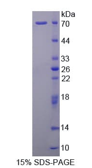 Human C1qRP / CD93 Protein (Recombinant His-GST)
