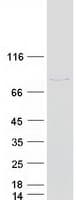 Human PARN Protein (Recombinant Myc-DDK (Flag))