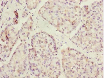 ERO1A / ERO1L Antibody
