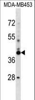 SRRD Antibody (aa184-213)