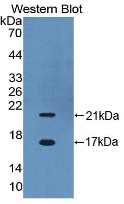 CBY1 / PGEA1 Antibody