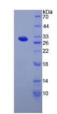 Human TG / Thyroglobulin Protein (Recombinant His-T7)