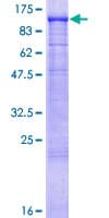 Human GAA / Alpha-Glucosidase, Acid Protein (Recombinant GST)