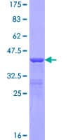Human Kappa Light Chain Protein (Recombinant GST)